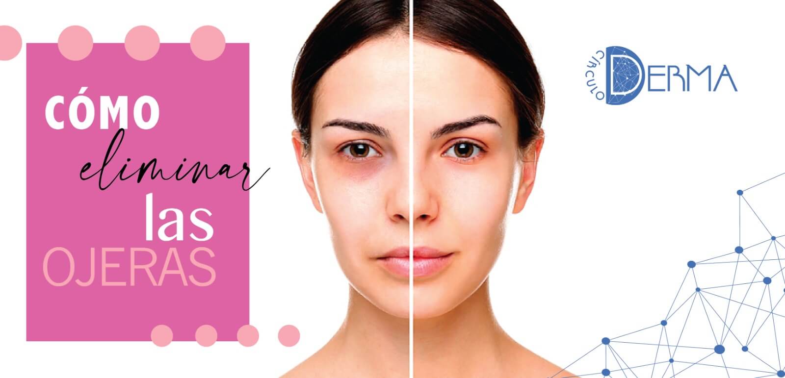 ¿Cómo disminuir las ojeras?